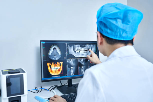 Best Emergency Wisdom Tooth Extraction in New Cassel, NY